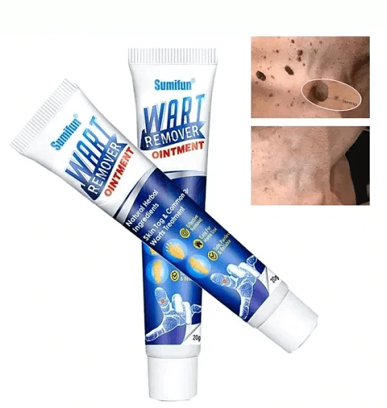 DERMACLEAR PRO™ - A SOLUÇÃO DEFINITIVA PARA UMA PELE RADIANTE E LIVRE DE VERRUGAS (LIQUIDAÇÃO POR FECHAMENTO)