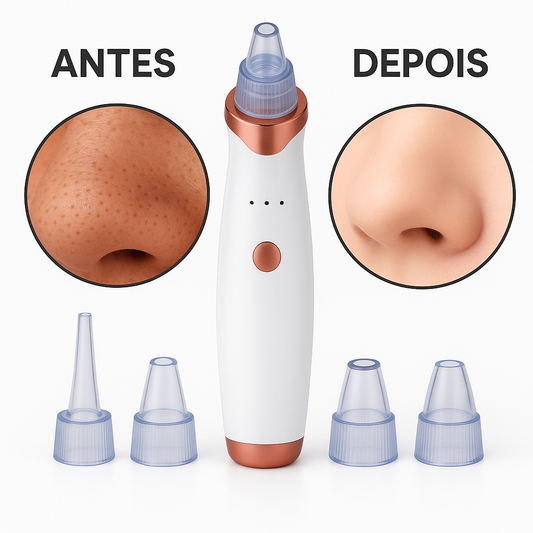 Limpador elétrico de pontos negros (LIQUIDAÇÃO)