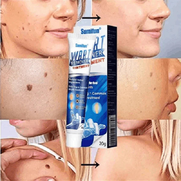 DERMACLEAR PRO™ - A SOLUÇÃO DEFINITIVA PARA UMA PELE RADIANTE E LIVRE DE VERRUGAS (LIQUIDAÇÃO POR FECHAMENTO)