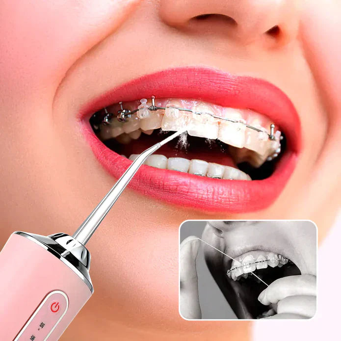 DENTASPLASH™ FRESCOR E LIMPEZA EM CADA GOTÍCULA (LIQUIDAÇÃO DE FECHAMENTO)